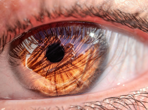 多焦点眼内レンズの構造 – 屈折型と回折型 –