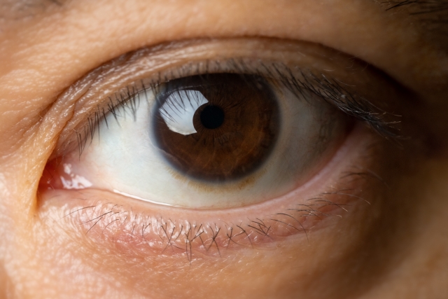 クラレオン パンオプティクス (Clareon PanOptix)とは