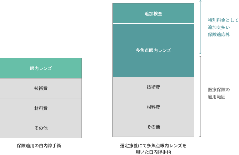 単焦点レンズと多焦点レンズの費用比較図