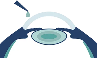 点眼のイメージ