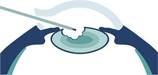 点眼のイメージ