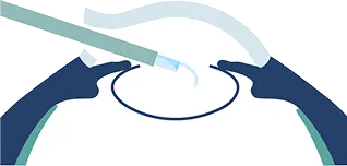 点眼のイメージ