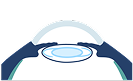 点眼のイメージ